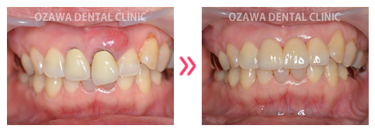 審美歯科 症例ケース03